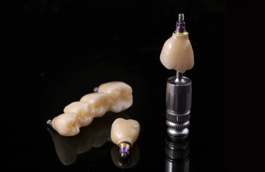 Ceramic and titanium implant restorations, photographed for Bixby Knolls Dental Group.